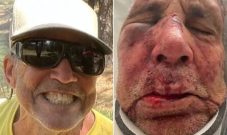 71-Year-Old Arizona Man With Brain Tumor Seriously Injured in Random Dog-Walking Attack