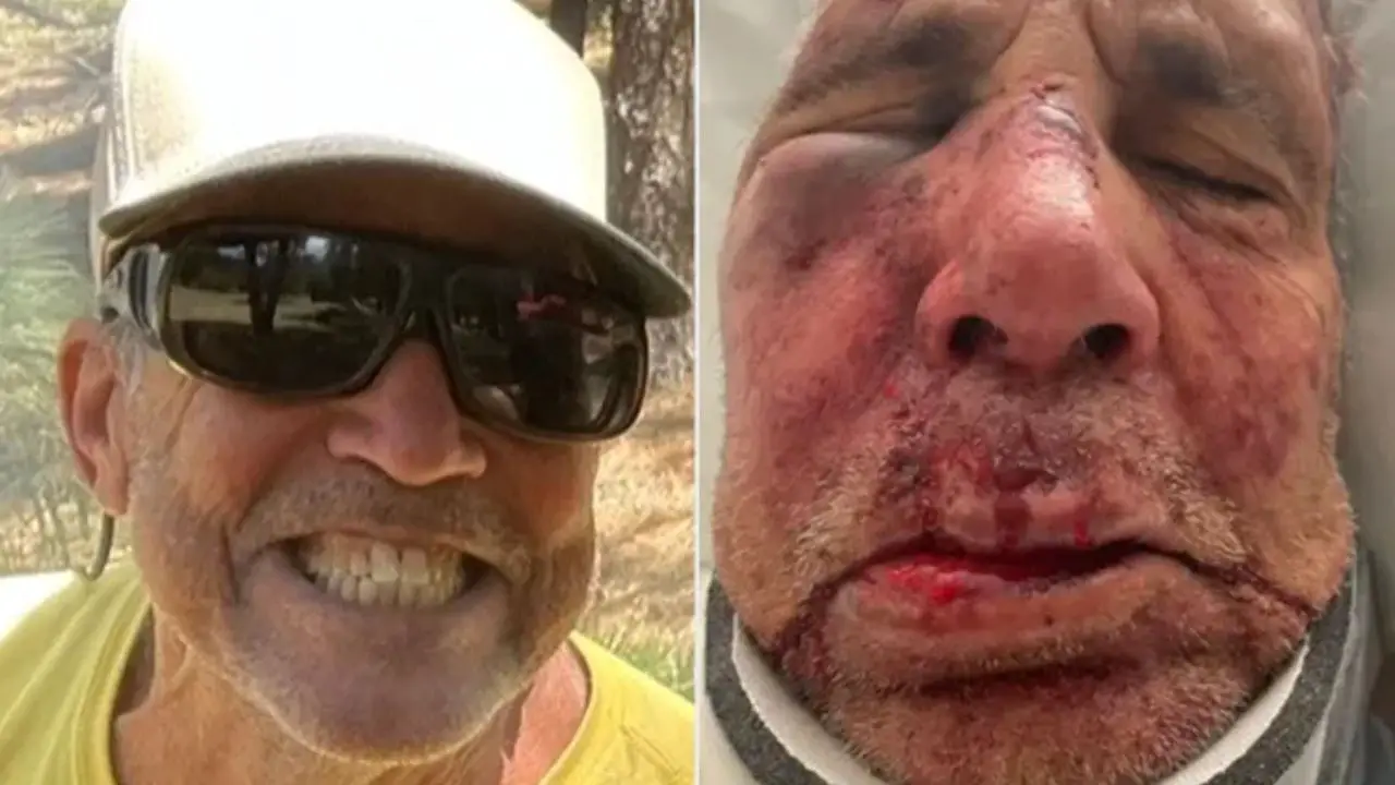 71-Year-Old Arizona Man With Brain Tumor Seriously Injured in Random Dog-Walking Attack